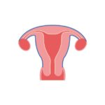 Endometrioza